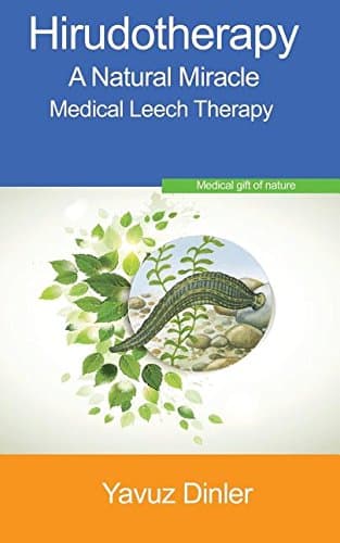 Hırudotherapy: The Medıcal Leech Therapy