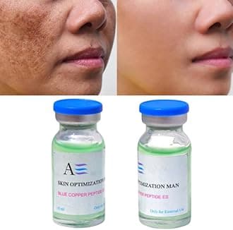 Dark spot Serum For Hyperpigmentation & Melasma | Brightens skin tone Chehre ke daag hatane wali Twacha ko gora karne ka cream