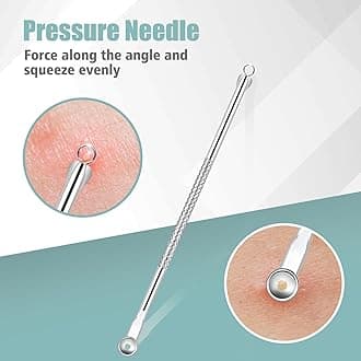 Blackhead Remover Tweezers Tools, Pimple Popper Tool Kit, Ingrown Hair Tweezers, Blackhead Pimple Extractor