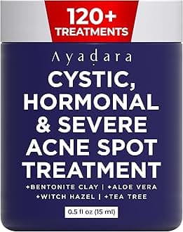 Cystic Acne Spot Treatment, Overnight Hormonal Cystic Acne Treatment for Face, Women, Men and Teens, Cystic Hormonal Acne Treatment for Body, Pimple Cream, Sulfur Acne Spot Treatment, 120 Uses